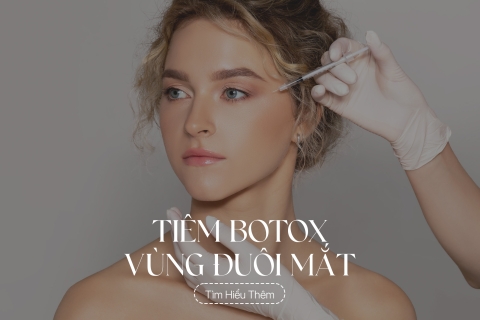 Tiêm Botox vùng đuôi mắt